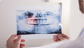 Extractions And Wisdom Teeth