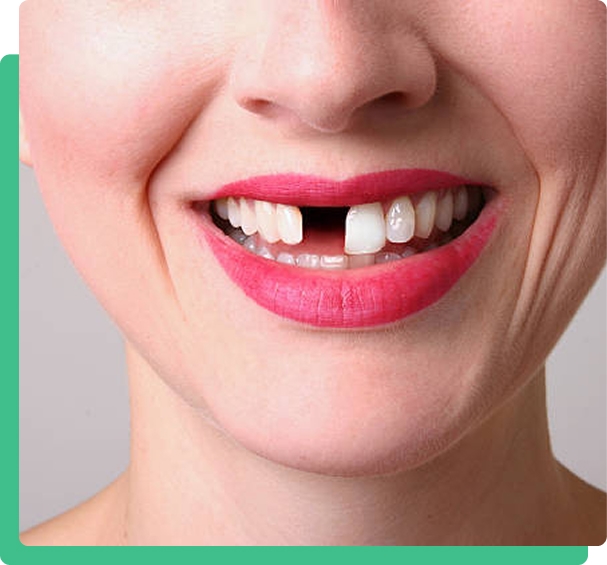 Are you embarrassed about your smile or do you suffer from confidence issues due to missing or loose teeth?