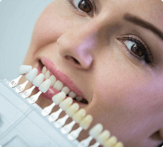 Porcelain Fused Metallic Crowns