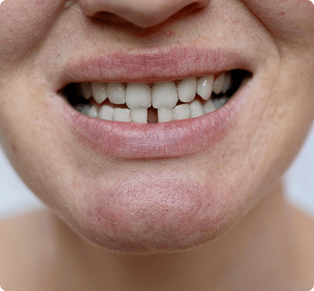 Are your teeth stained, chipped, or not aligned?