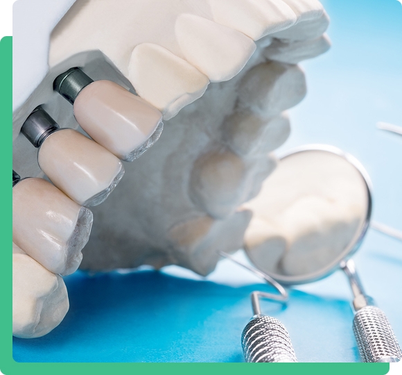 Treatment illustration